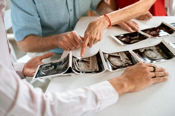 Konsultacja przed rozpoczęciem programu – para omawia USG z lekarzem