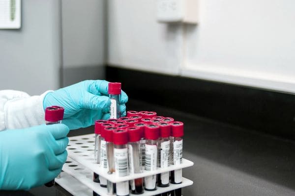 Wpływ wieku kobiety na AMH i jakość komórek jajowych